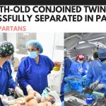 Muhammad Ayan and Muhammad Aman 9-Month-Old Conjoined Twins Successfully Separated in Pakistan