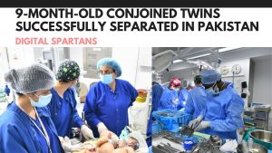 Muhammad Ayan and Muhammad Aman 9-Month-Old Conjoined Twins Successfully Separated in Pakistan