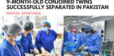 Muhammad Ayan and Muhammad Aman 9-Month-Old Conjoined Twins Successfully Separated in Pakistan
