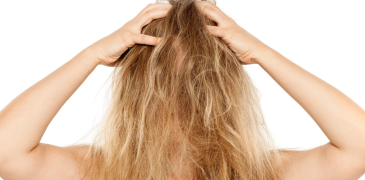 3 Most Common Winter Hair Problems and Their Solutions