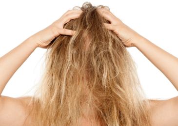 3 Most Common Winter Hair Problems and Their Solutions