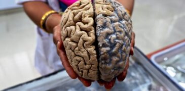 Microplastics Found in Human Brain: Study Unveils Unseen Health Risks