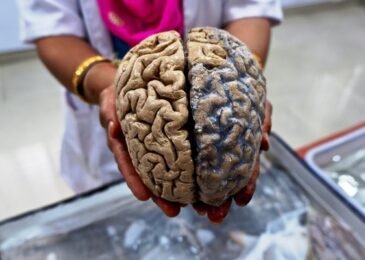 Microplastics Found in Human Brain: Study Unveils Unseen Health Risks